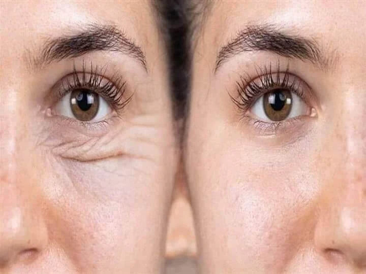 CONTORNO DE OJOS REAFIRMANTE CON PULPA DE ARROZ (COMBO 2X1)
